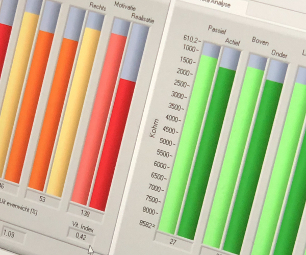 Raymedy graphs